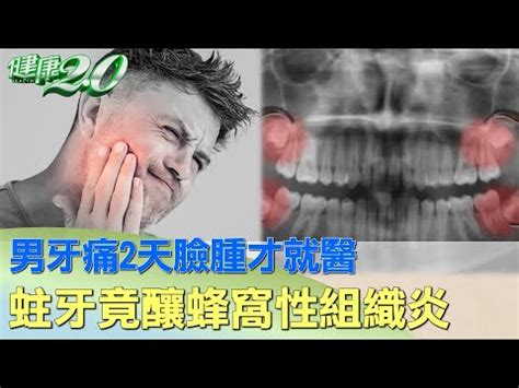 牙痛臉腫怎麼消